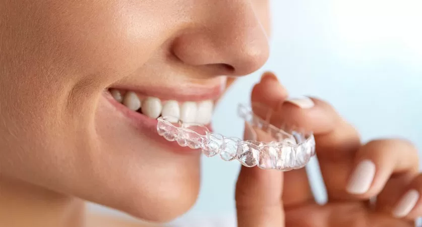 Invisalign braces near me