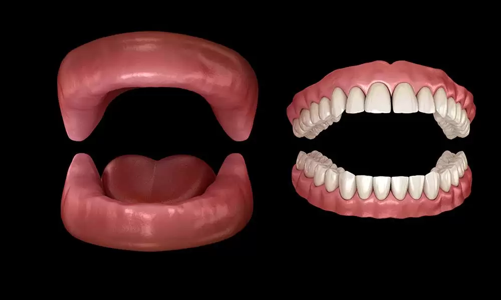 dentures Houston